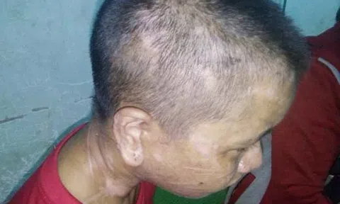 Cô gái đi làm thuê bị tra tấn dã man: Đánh sẩy thai, đắp lá sắn để cầm máu